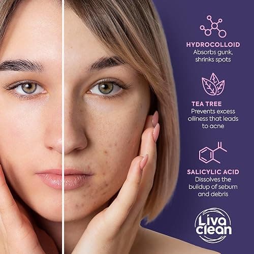 LivaClean 240 Count Colorful Star-Shaped Pimple Patches for Face – Hydrocolloid Acne Patches with Salicylic Acid – Cute Pimple Patches, Pimple Stickers, Zit Dots, Hydrocolloid Bandages, Acne Stickers thumbnail 6