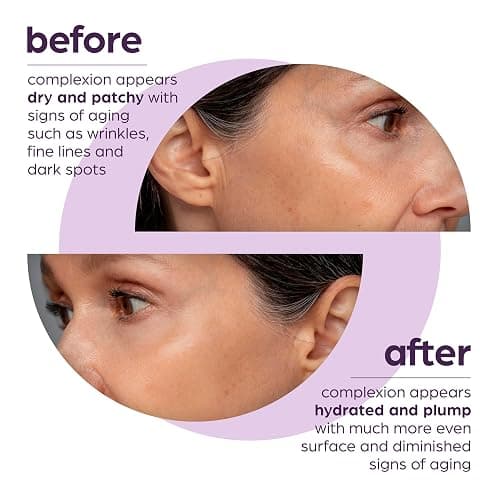 50% Beta Glucan Anti-Aging, Plumping Serum thumbnail 6