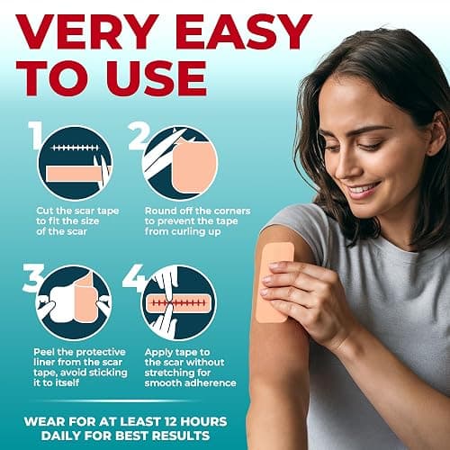 Medical Grade Silicone Scar Tape - 1.6”x150” - Visible Difference on Keloid & С-Section - Reusable Silicone Scar Sheets - Easy to Use - 150"x1.6" - Beige thumbnail 5