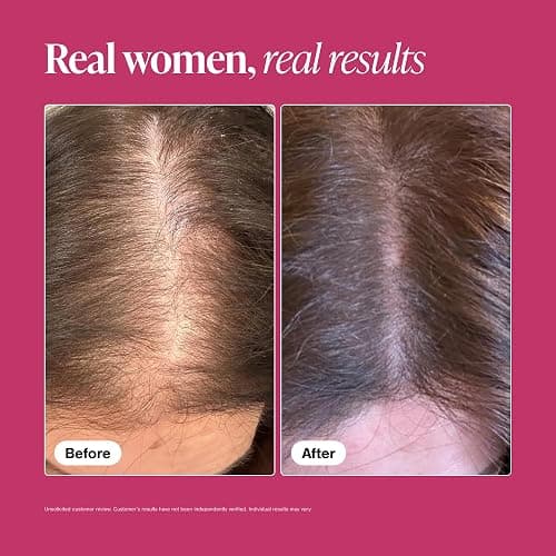 Viviscal Hair Growth Supplements for Women, Thicker Fuller Hair Support for Thinning Hair and Hair Loss, with Biotin and Marine Collagen, Drug-Free, 180 Tablets, 90-Day Supply thumbnail 6