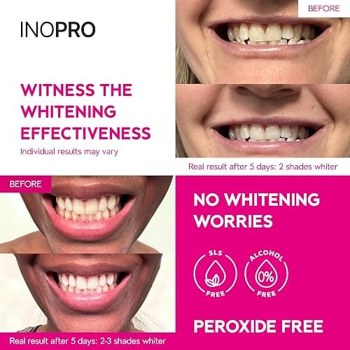 InoPro Teeth Whitening Strips 21 Treatments Kit - Teeth Whitener, Peroxide Free, Green White Strips for Teeth Whitening with Arbutin, Coconut Oil, Deep Stains Removal (42 Strips) thumbnail 3