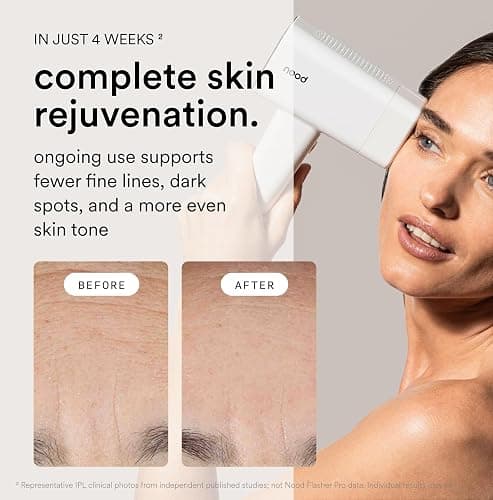Nood™ Flasher Pro — Forbes Best Product 2026 — IPL Laser Hair Removal Device For At Home Use — Pain-Free, Permanent, Visible Results After First Use & Works Everywhere Hair Grows — Gloss White thumbnail 4