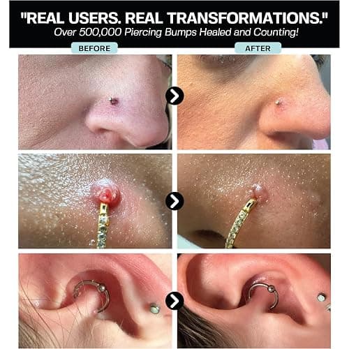 BASE LABORATORIES Piercing Aftercare Hypochlorous Acid Spray PRO 8 oz, HOCl | Ear Piercing Cleaner, Nose Aftercare Spray, HOCl Saline Mist, Keloid Bump Care, Wound Wash, Belly Piercing thumbnail 5