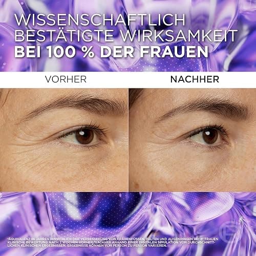 L'Oréal Paris Augenserum für Frauen: sorgt für eine aufgepolsterte Augenpartie und weniger dunkle Augenringemit 2,5% [Hyaluronsäure+Koffein], Revitalift Filler, 1x 20ml thumbnail 4