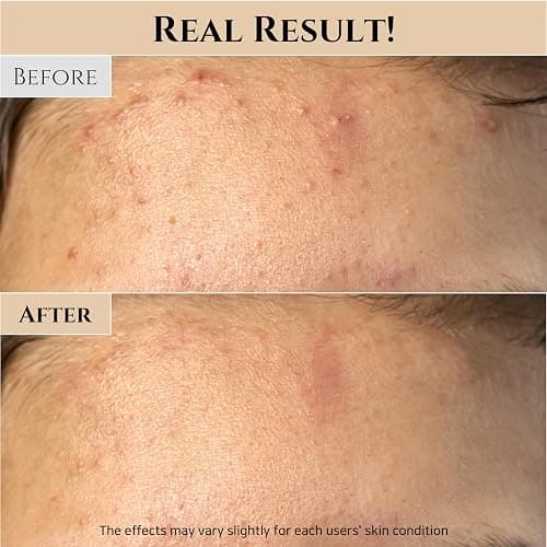 Beauty of Joseon Reis- und Honig-Glow-Maske zur Pflege der Poren und Sebumkontrolle für trockene, empfindliche Haut, koreanische Hautpflege für Männer und Frauen, 150 ml thumbnail 5