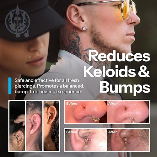 H2Ocean Piercing Aftercare Spray and Keloid Bump Removal– Sea Salt Spray for Body and Facial Piercings – Ear, Nose, Navel, Oral & Body Piercing Cleaner, Aftercare Solution for New Piercings– 4oz thumbnail 5