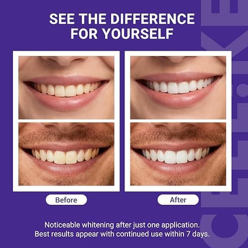 CEELIKE Teeth Whitening Strips (21 Treatments/42 Strips) - Peroxide-Free Whitening Kit with Hydroxyapatite, Enamel Safe + Cheek Retractor, Easy 3-Step at-Home Teeth Whitening for Deep Stain Removal thumbnail 3