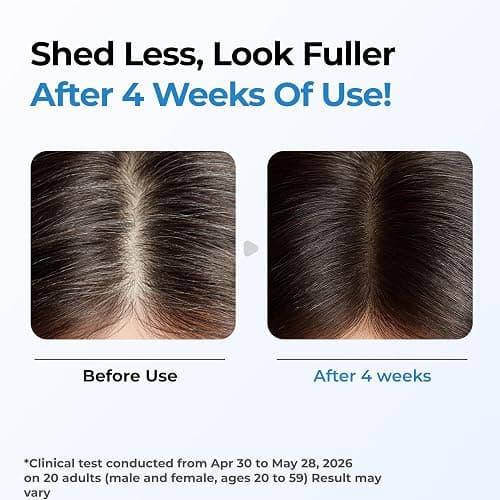 Seapuri Scalpy Hair Growth Serum for Thinning Hair | Korean Scalp Treatment with Salicylic Acid, Menthol, Dexpanthenol | Supports Hair Density & Thickening | Fuller Looking Hair & Scalp Health thumbnail 5