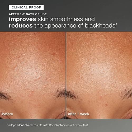 Dermalogica Daily Microfoliant, Face Exfoliator Scrub Powder with Salicylic Acid and Papaya Enzyme, Achieve Brighter, Smoother Skin Daily thumbnail 5