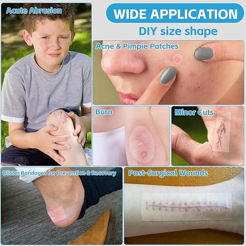 Hydrocolloid Bandages for Wound Care, Medical-Grade Hydrocolloid Roll with Self-Adhesive, Ultra Absorbent, Flexible & Waterproof, Cut-to-Size First Aid Kit Essential (2in*4.8ft) thumbnail 3