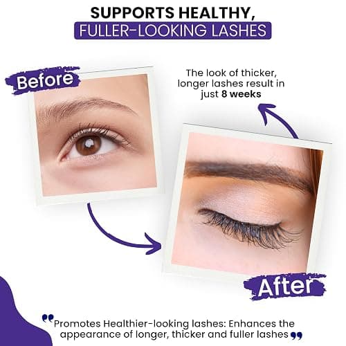 RapidLash Eyelash Enhancing Serum with HEXATEIN 1 Complex – Lash Serum for Eyelashes Conditioning & Hydrating – Longer-Looking, Fuller and Thicker Appearing Lashes – 3 mL / 0.1 fl oz thumbnail 6
