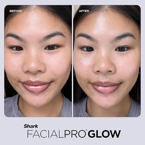 Shark FacialPro Glow at-Home Hydro-Powered Facial System with DePuffi Hot & Cold Therapy – Professional Spa Skincare Device for Pore Cleansing, Hydration, & Radiant Glow, Lilac, FH320PL thumbnail 12