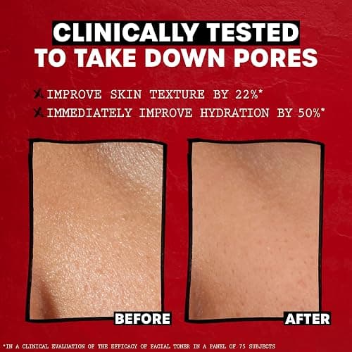 THAYERS Alcohol-Free, Hydrating, Unscented Witch Hazel Facial Toner with Aloe Vera Formula, Vegan, Dermatologist Tested and Recommended, 12 Oz (Packaging May Vary) thumbnail 5