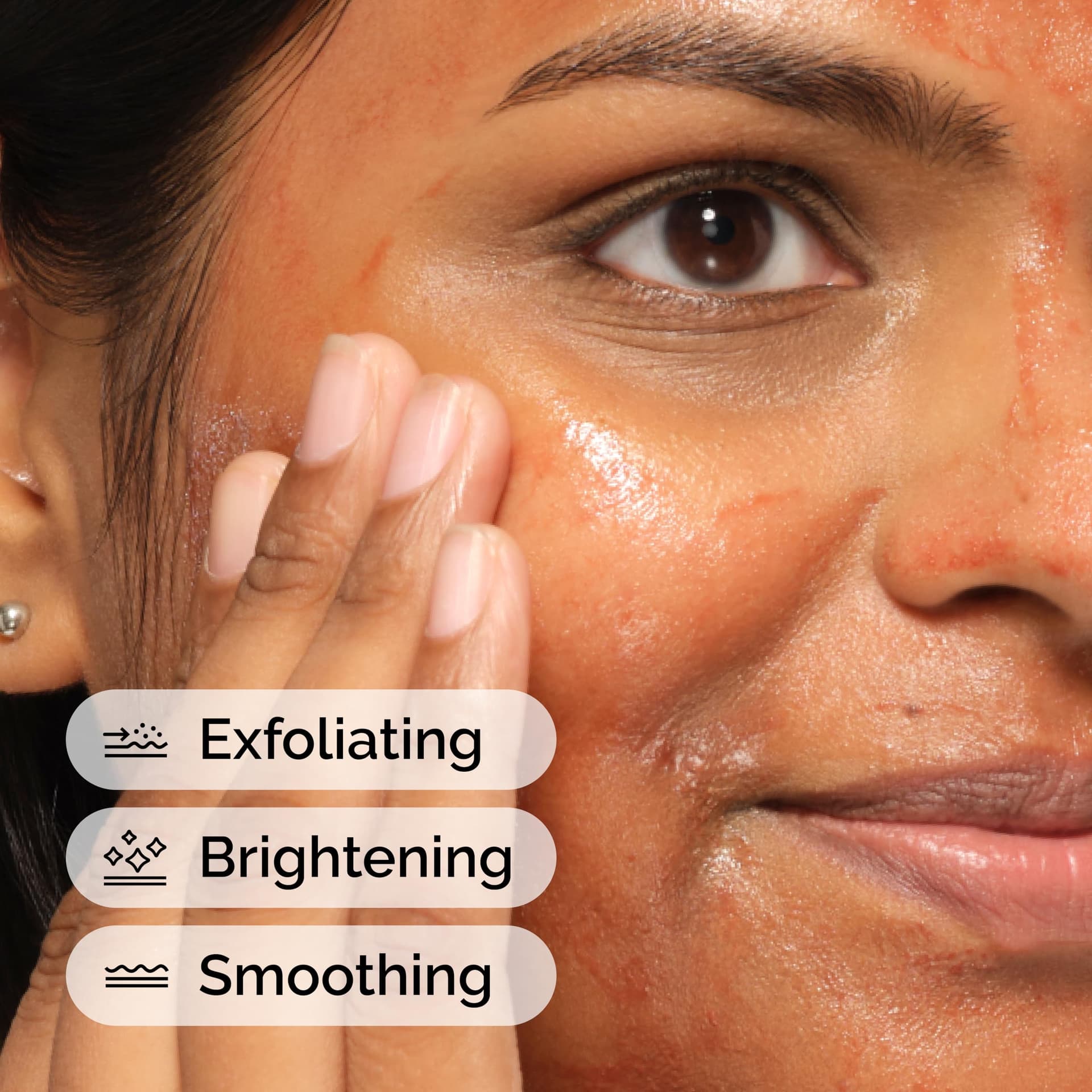 The Ordinary AHA 30% + BHA 2% Peeling Solution 30ml - Esfoliante Facial - Tratamento thumbnail 2