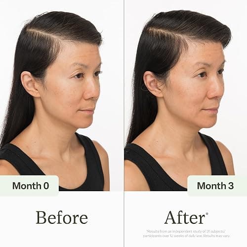 Divi Scalp Serum for Thinning Hair Clinically Tested, Non-Greasy Formula with Amino Acids, Caffeine & Rosemary Oil Promotes Healthy Scalp & Fuller-Looking Hair, Reduces Oil & Product Buildup thumbnail 4
