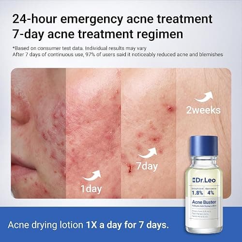 Dr.Leo 1.8% Salicylic Acid Spot Serum, Acne Treatment for Acne-Prone Sensitive Skin | Niacinamide, Fast Pimple Relief, Fades Acne Marks, Overnight & Period Breakouts, 0.34 fl oz (20 ml) thumbnail 7