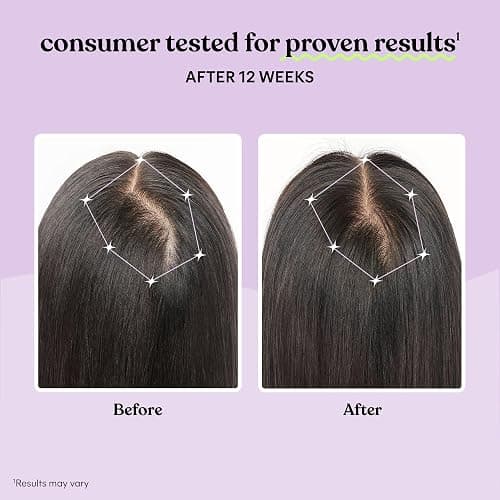 Lemme Grow Hair Growth Supplement for Women, Clinically Proven Keratin Complex for Visibly Thicker Hair and Scalp Coverage, Reduced Shedding, Nourish Thinning Hair - 1 Month Supply thumbnail 4