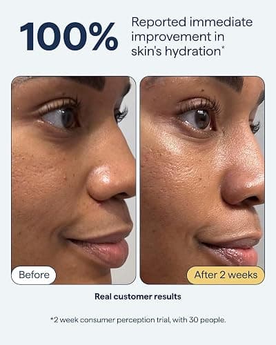 Remedy for Rich Moisture - Barrier Repairing Rich Cream Moisturizer for Normal to Dry Skin - Quadruple Ceramide Complex, Peptides, Squalane, Glycerin- By Dermatologist Dr. Shah, 1.7 fl. oz thumbnail 4