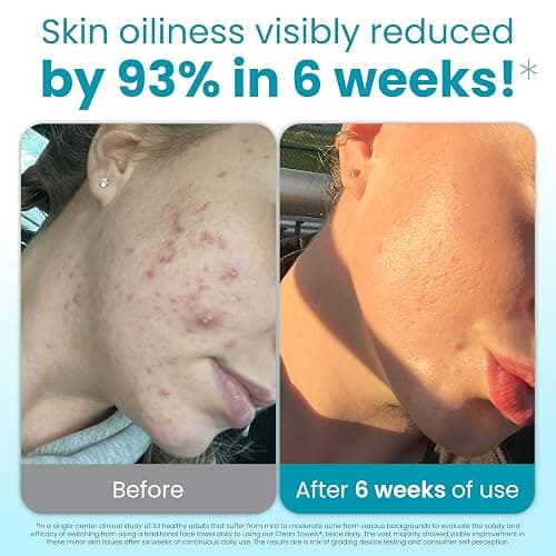 Clean Skin Club Blemish Control Clean Towels® XL, Compostable Face Towels, Light Exfoliation for Oily Skin, Eczema Association Accepted Disposable Face Towelette, Makeup Remover Dry Wipes, 50 count thumbnail 2