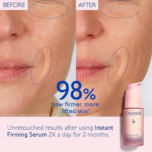Caudalie Resveratrol-Lift Instant Firming Retinol Alternative Serum, Refillable - 30 mL thumbnail 3