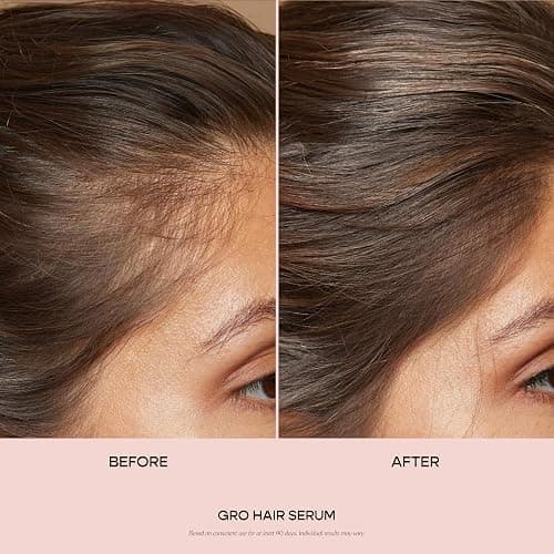 VEGAMOUR GRO Hair Serum for Hair Thinning & Shedding, Thicker Fuller Looking Hair In As Soon As 90 Days, Non Oily, Bergamot Scent, Vegan & Cruelty Free thumbnail 2