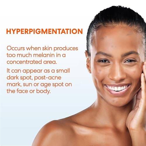 Palmer's Skin Success Anti-Dark Spot Fade Cream with Vitamin E and Niacinamide, for All Skin Types 2.7 Ounce thumbnail 7