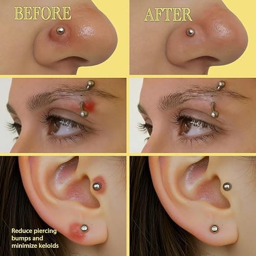 BodyJ4You Keloid Bump Removal Oil - Piercing Aftercare Shrinking Drops - Nose Ear Septum Belly Cartilage Scar Treatment Piercing Bump Solution - Tea Tree Jojoba Essential Oils Keloid Care (Pack of 2) thumbnail 3