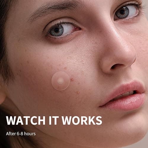 Daolyo Pimple Patches for Face, 4 Size 300 Counts Acne Patches, Hydrocolloid Patches for Covering Zits and Blemishes, Spot Stickers with Salicylic Acid, Tea Tree Oil & Calendula Oil thumbnail 4