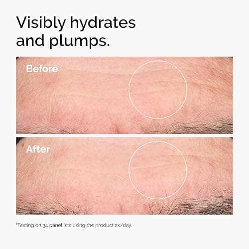 The Ordinary Hyaluronic Acid 2% + B5 (with Ceramides), Multi-Depth Hydration Serum for Plumper, Smoother Skin thumbnail 2