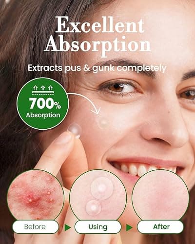 Troubless Invisible Pimple Spot Patch - 96 Ultra Thin Acne Patches - Easy Peel - 2 Sizes thumbnail 5