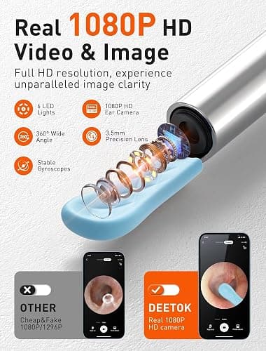 Ear Wax Removal Tool Camera - Ear Cleaner with 1080P HD Camera, Otoscope with Light, Earwax Removal Kit with 50 Replacement Tips for iPhone, iPad, Android Phones (Black) thumbnail 2