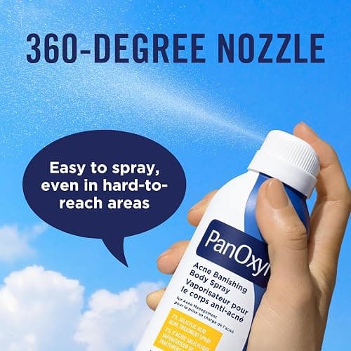 PanOxyl Acne Banishing Body Spray with 2% Salicylic Acid, Pimple Treatment to Help Clear Stubborn Breakouts, 360-Degree Spray Nozzle, Skin-Brightening Niacinamide, Vitamin C, Witch Hazel, Aloe, 170g thumbnail 5