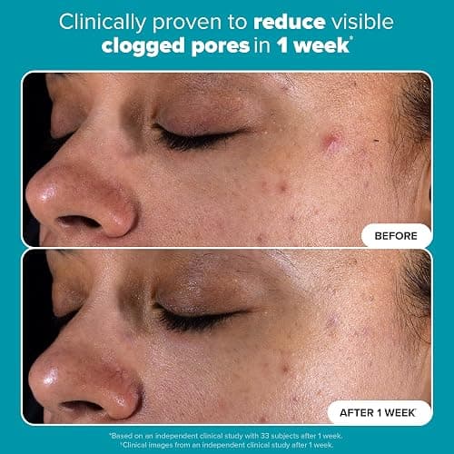 Paula's Choice SKIN PERFECTING 2% BHA Liquid Exfoliant with Salicylic Acid, Facial Polish for Enlarged Pores, Wrinkles & Fine Lines, Suitable for Blackhead-Prone Skin, Fragrance-Free thumbnail 5