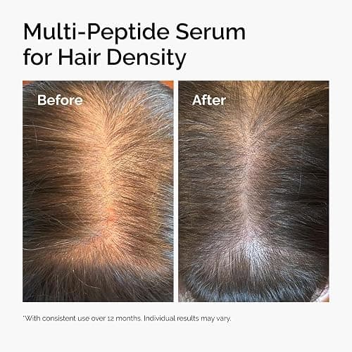 The Ordinary Multi-Peptide Serum for Hair Density and Scalp Support, Peptide-Powered Formula for Thicker, Fuller Looking Hair, 60ml thumbnail 4