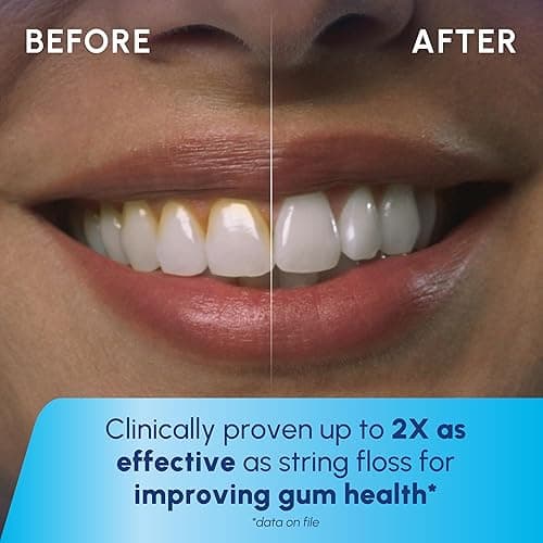 Waterpik Cordless 1100 Rechargeable Portable Water Flosser for Teeth Cleaning and Flossing, Travel, Braces Care, Healthier Gums, Waterproof for Shower, ADA Accepted, WF-30CD White, Packaging May Vary thumbnail 6