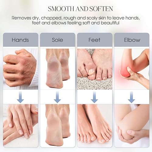 Achzzy Paraffin Wax Machine for Hands and Feet, 4000ml Paraffin Bath, Paraffin Wax Warmer with Refills, Nourishing and Moisturizing, Professional-Grade Spa Treatment for Soft and Smooth Skin thumbnail 7