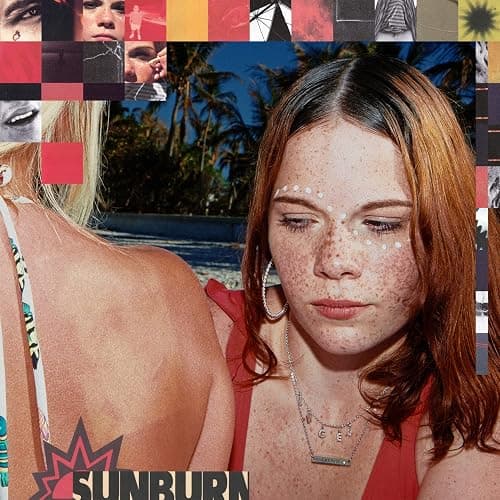 Sunburn - Image 1