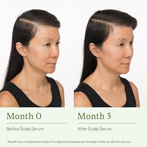 Divi Healthy Hair Goals Mini Kit, Scalp Serum for Thinning Hair 15ml + Volumizing Shampoo Travel Size 2oz + Volumizing Conditioner Travel Size 2oz, 3 Piece Set thumbnail 4