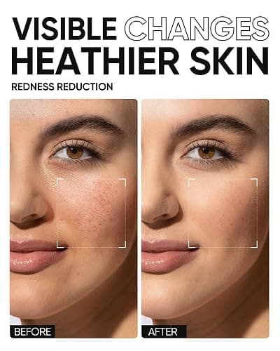 SKINTIFIC 5X Ceramides Moisture Barrier Cream, Hydrating Skin Barrier Repair Face Moisturizer for All Skin Types with Hyaluronic Acid & Centella, Daily Moisturizer, Non-Comedogenic thumbnail 5