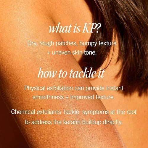 First Aid Beauty KP Bump Eraser Body Scrub with 10% AHA, Keratosis Pilaris Skin Exfoliator with Glycolic and Lactic acids, Helps Reduce Chicken Bumps, Safe for Sensitive Skin, 8 oz thumbnail 4