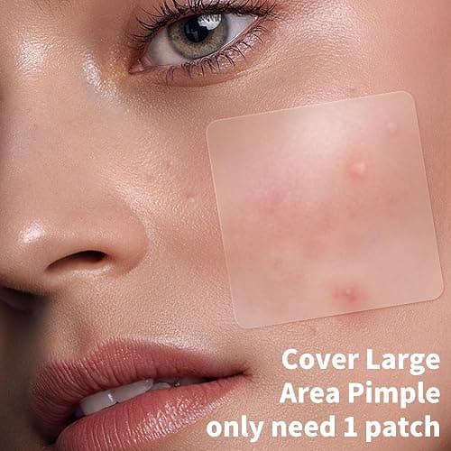 Daolyo Large Pimple Patches for Face, 7 Sizes 210 Counts XL Acne Patches, Big Hydrocolloid Bandages for Body, Chin, Forehead, Chest, Back Zit Breakouts (Strip, Square, Round) thumbnail 5