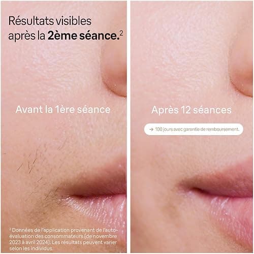 Braun Epilateur Lumiere Pulsee Silk·expert Pro 5 PL5156, Blanc et Or | Alternative au Laser à Domicile, Filaire, avec Pochette, Rasoir Gillette Venus, 2 Têtes thumbnail 3