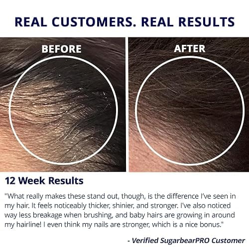 Sugarbear Bamboo Scalp Massager & Scrubber + Vegan Hair Vitamin Gummies 3 Month Supply, Extra Strength Biotin 6000mcg for Relaxing Scalp Care & Supporting Healthy Hair thumbnail 5