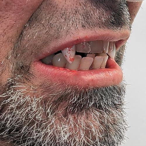 Treasure Gurus Realistic Fake Blood Capsules Vampire Cosplay SFX Makeup Halloween Party Costume Accessory thumbnail 5