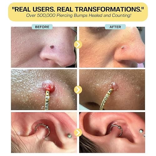 Base Labs Piercing Bump Solution thumbnail 4