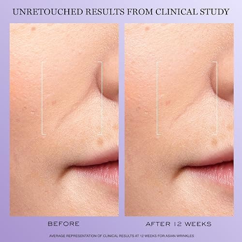 Lancôme Rénergie H.C.F. Triple Serum - Hyaluronic Acid Serum for Visible Correction of Anti Aging Signs & Dark Spots - With Vitamin C+, Niacinamide & Ferulic Acid thumbnail 3