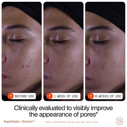 Youth To The People Superfruit Facial Cleanser - Papaya + Vitamin C Gentle Exfoliating Face Wash, Cellular Skin Renewal with AHA + BHA, Evens Skin Tone & Texture for Soft + Radiant Skin, Sulfate-free thumbnail 7