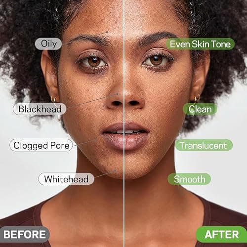 AMOADO Blackhead Remover Mask, Charcoal Peel Off Face Mask Kit, (100g) Deep Pore Cleans,Oil Control, Blackheads Removal Peel Off Black Mask for Men & Women – Includes Brush,Extractor Tool thumbnail 5