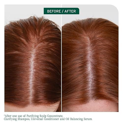 Biolage Scalp Sync Clarifying Shampoo - Residue & Buildup Remover, For Oily Scalp, With Fermented Tea & Glycolic Acid, Vegan & Paraben-Free, Packaging May Vary thumbnail 3