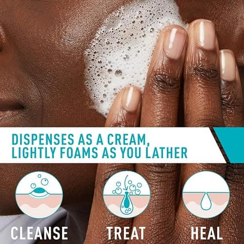 CeraVe Acne Foaming Cream Cleanser, 4% Benzoyl Peroxide Face Wash With Hyaluronic Acid, Niacinamide & Ceramides, Gentle Daily Acne Treatment For Face thumbnail 3